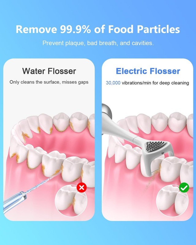 Rechargeable Electric Flosser – 4-Speed Dental with 60 Heads M, White gallery